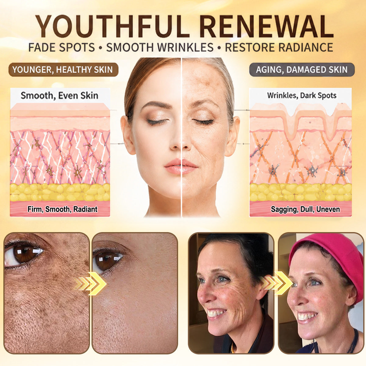 HISKIN® Bust Volume, Lift & Firming Nano Microneedle Patch Volufiline + Exosome + Copper Peptide Formula Powered by Cellular Renewal Technology