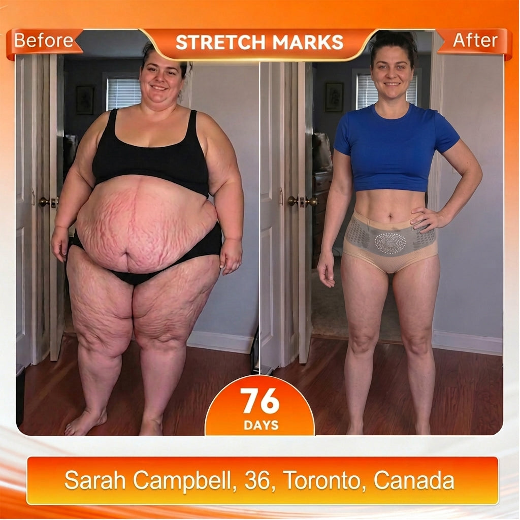 ca 𝐎𝐟𝐟𝐢𝐜𝐢𝐚𝐥 𝐁𝐫𝐚𝐧𝐝 𝐒𝐭𝐨𝐫𝐞 🌟 𝑨𝑳𝑳𝒀𝑩𝑬𝑬® 𝟐𝟎𝟐𝟔 𝐌𝐨𝐫𝐢𝐧𝐠𝐚 & 𝐁𝐞𝐫𝐛𝐞𝐫𝐢𝐧𝐞 𝟒-𝐈𝐧-𝟏 𝐌𝐢𝐜𝐫𝐨-𝐏𝐚𝐫𝐭𝐢𝐜𝐥𝐞 𝐒𝐜𝐮𝐥𝐩𝐭𝐢𝐧𝐠 & 𝐅𝐚𝐭-𝐁𝐮𝐫𝐧 𝐒𝐡𝐨𝐫𝐭𝐬