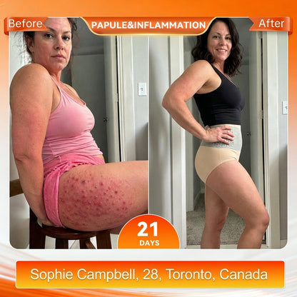 ca 𝐎𝐟𝐟𝐢𝐜𝐢𝐚𝐥 𝐁𝐫𝐚𝐧𝐝 𝐒𝐭𝐨𝐫𝐞 🌟 𝑨𝑳𝑳𝒀𝑩𝑬𝑬® 𝟐𝟎𝟐𝟔 𝐌𝐨𝐫𝐢𝐧𝐠𝐚 & 𝐁𝐞𝐫𝐛𝐞𝐫𝐢𝐧𝐞 𝟒-𝐈𝐧-𝟏 𝐌𝐢𝐜𝐫𝐨-𝐏𝐚𝐫𝐭𝐢𝐜𝐥𝐞 𝐒𝐜𝐮𝐥𝐩𝐭𝐢𝐧𝐠 & 𝐅𝐚𝐭-𝐁𝐮𝐫𝐧 𝐒𝐡𝐨𝐫𝐭𝐬